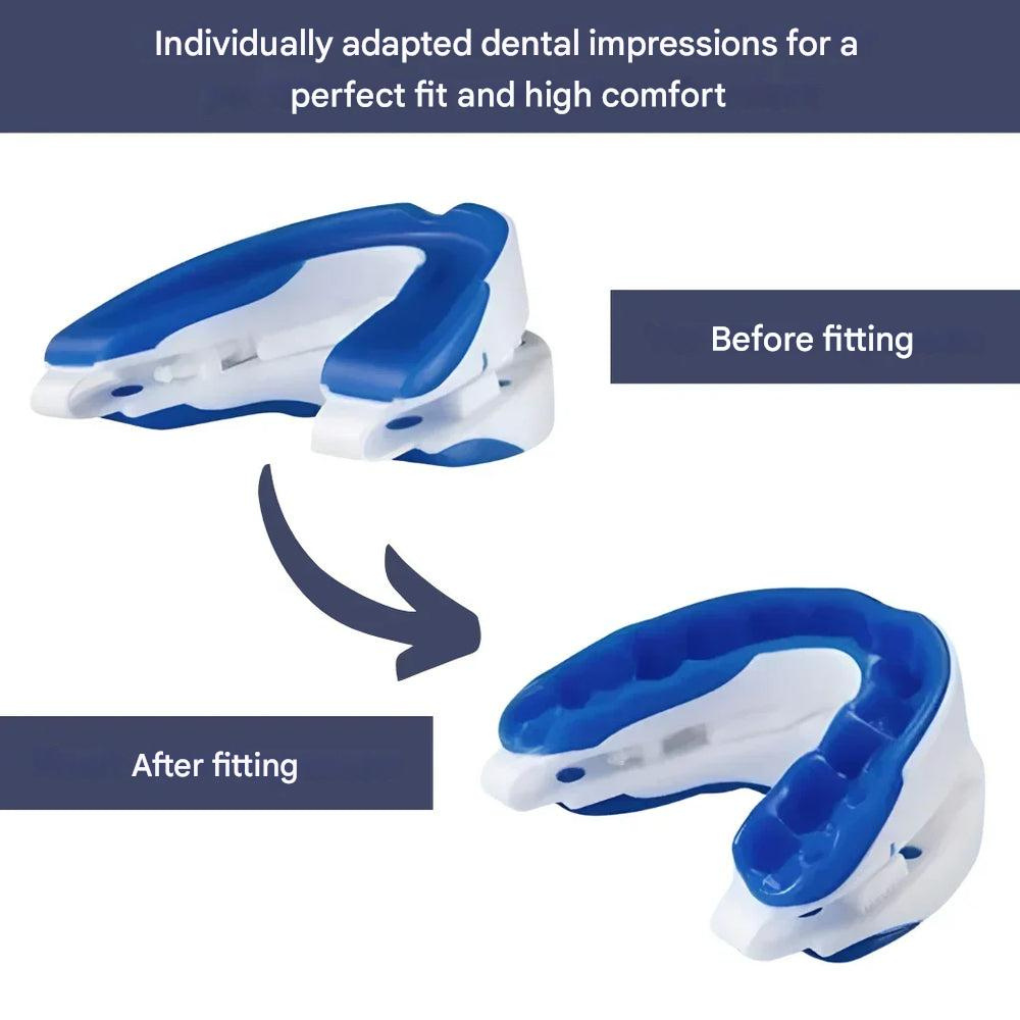Anti‑Snore Mouthpiece